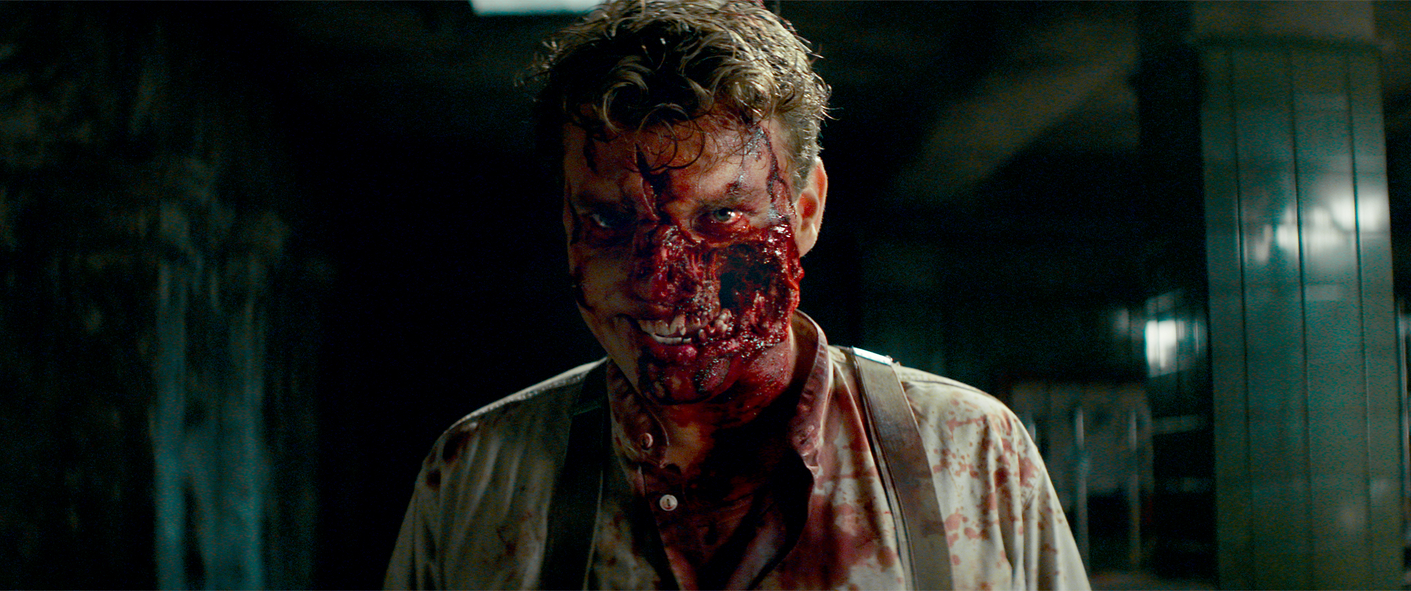 Wafner with his mouth and cheek cut open, covered in blood, in Overlord.